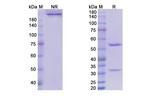 Tanezumab Humanized Antibody in SDS-PAGE (SDS-PAGE)