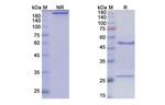 Anrukinzumab Humanized Antibody in SDS-PAGE (SDS-PAGE)