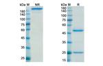 Dacetuzumab Humanized Antibody in SDS-PAGE (SDS-PAGE)