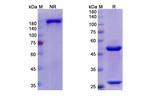 Otelixizumab Humanized Recombinant Human Monoclonal Antibody