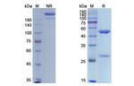 ITGAV/ITGB3 (Etaracizumab Biosimilar) Recombinant Human Monoclonal Antibody