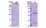Canakinumab Antibody in SDS-PAGE (SDS-PAGE)