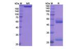 CTLA-4 (CD152) (Tremelimumab Biosimilar) Antibody in SDS-PAGE (SDS-PAGE)