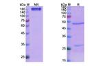 Denosumab Recombinant Human Monoclonal Antibody
