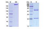 CD30 (Iratumumab Biosimilar) Antibody in SDS-PAGE (SDS-PAGE)