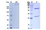 MUC1 (Sontuzumab Biosimilar) Recombinant Humanized mouse Monoclonal Antibody