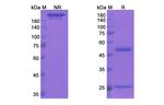 Bapineuzumab Humanized Recombinant Human Monoclonal Antibody