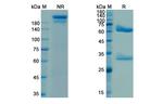 Lipoteichoic Acid (Pagibaximab Biosimilar) Recombinant Human Monoclonal Antibody