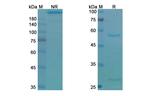 EpCAM (CD326) (Tucotuzumab Biosimilar) Recombinant Humanized mouse Monoclonal Antibody
