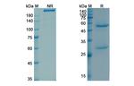 Tacatuzumab Humanized Antibody in SDS-PAGE (SDS-PAGE)