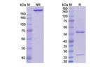 Volociximab Chimeric Recombinant Human Monoclonal Antibody