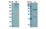 Raxibacumab Antibody in SDS-PAGE (SDS-PAGE)