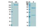 Tefibazumab Humanized Recombinant Human Monoclonal Antibody