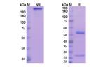 Exbivirumab Antibody in SDS-PAGE (SDS-PAGE)