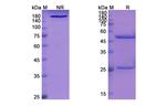 Hepatitis B Virus Surface Antigen (Libivirumab Biosimilar) Antibody in SDS-PAGE (SDS-PAGE)