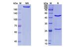 Urtoxazumab Humanized Recombinant Human Monoclonal Antibody