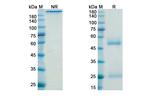 Belimumab Recombinant Human Monoclonal Antibody