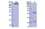 Elsilimomab Recombinant Mouse Monoclonal Antibody