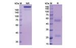 Pritumumab Antibody in SDS-PAGE (SDS-PAGE)