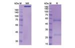 Aselizumab Humanized Recombinant Human Monoclonal Antibody
