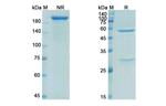 Ecromeximab Chimeric Recombinant Human Monoclonal Antibody