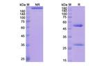 Teneliximab Chimeric Antibody in SDS-PAGE (SDS-PAGE)