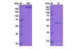 Vapaliximab Chimeric Antibody in SDS-PAGE (SDS-PAGE)