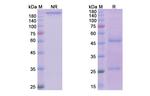 Reslizumab Humanized Recombinant Human Monoclonal Antibody