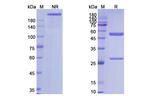 Lemalesomab Recombinant Mouse Monoclonal Antibody