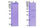 Taplitumomab Recombinant Mouse Monoclonal Antibody