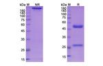 Bivatuzumab Humanized Recombinant Human Monoclonal Antibody