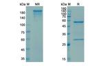 Sibrotuzumab Humanized Antibody in SDS-PAGE (SDS-PAGE)