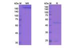 Cixutumumab Antibody in SDS-PAGE (SDS-PAGE)