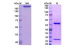 Folate Receptor alpha (Farletuzumab Biosimilar) Antibody in SDS-PAGE (SDS-PAGE)