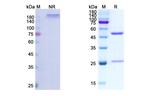 IGF1R (CD221) (Figitumumab Biosimilar) Antibody in SDS-PAGE (SDS-PAGE)