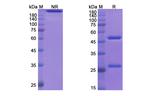 Necitumumab Antibody in SDS-PAGE (SDS-PAGE)