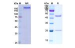 FLK1 (VEGF Receptor 2) (Ramucirumab Biosimilar) Antibody in SDS-PAGE (SDS-PAGE)