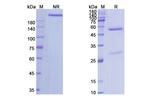 Robatumumab Recombinant Human Monoclonal Antibody