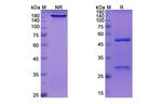 Vedolizumab Humanized Antibody in SDS-PAGE (SDS-PAGE)