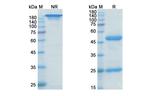 Rilotumumab Antibody in SDS-PAGE (SDS-PAGE)