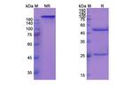 Rovelizumab Humanized Recombinant Human Monoclonal Antibody
