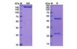 Faralimomab Antibody in SDS-PAGE (SDS-PAGE)