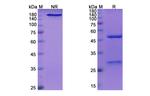 Nerelimomab Antibody in SDS-PAGE (SDS-PAGE)