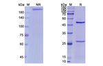 Minretumomab Antibody in SDS-PAGE (SDS-PAGE)