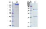 Morolimumab Recombinant Human Monoclonal Antibody