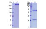 Altumomab Antibody in SDS-PAGE (SDS-PAGE)