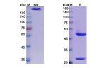 Detumomab Antibody in Western Blot (WB)