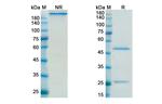 IFN alpha (Sifalimumab Biosimilar) Antibody in SDS-PAGE (SDS-PAGE)