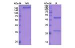 IL-22 (Fezakinumab Biosimilar) Recombinant Human Monoclonal Antibody