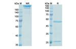 Lebrikizumab Humanized Antibody in SDS-PAGE (SDS-PAGE)